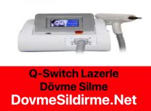 Q-Switch Lazerle Dövme Silme Nedir?