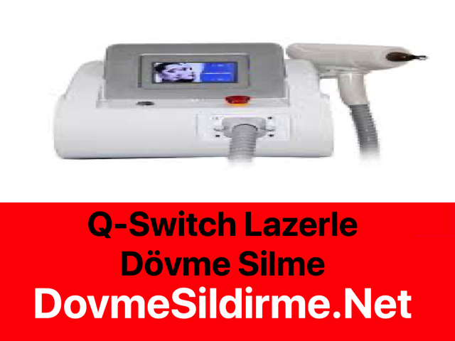 Q-Switch Lazerle Dövme Silme Nedir?