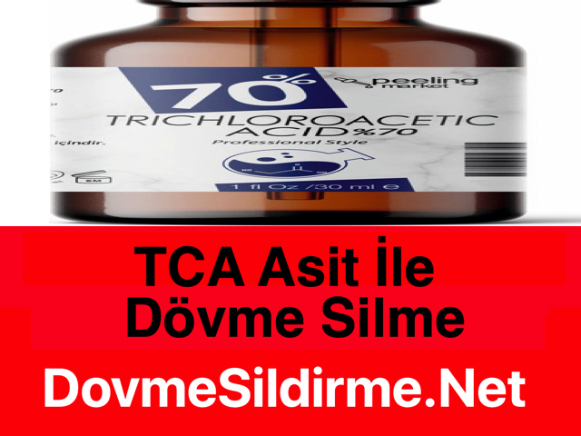 Peeling Market TCA %70 Dövme Silme Asidi Nasıl? Yorumlar