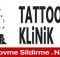 Avcılar - Klinik Tattoo Dövme Silme Nasıl? Yorumlar Gidenler