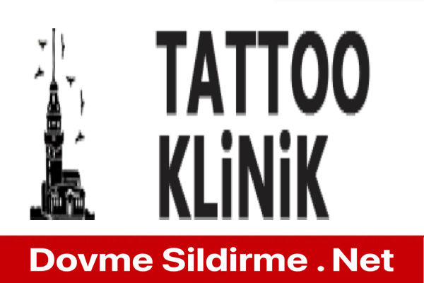 Avcılar - Klinik Tattoo Dövme Silme Nasıl? Yorumlar Gidenler