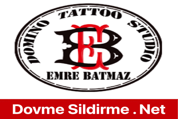 Denizli Domino Tattoo Dövme Silme Nasıl? Yorumları